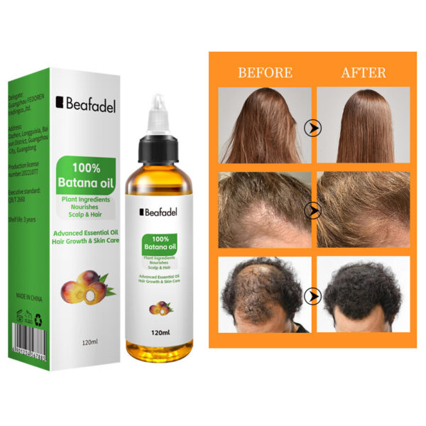 Batana Hair Care Oil – 100% Natural Scalp & Hair Treatment - Image 4
