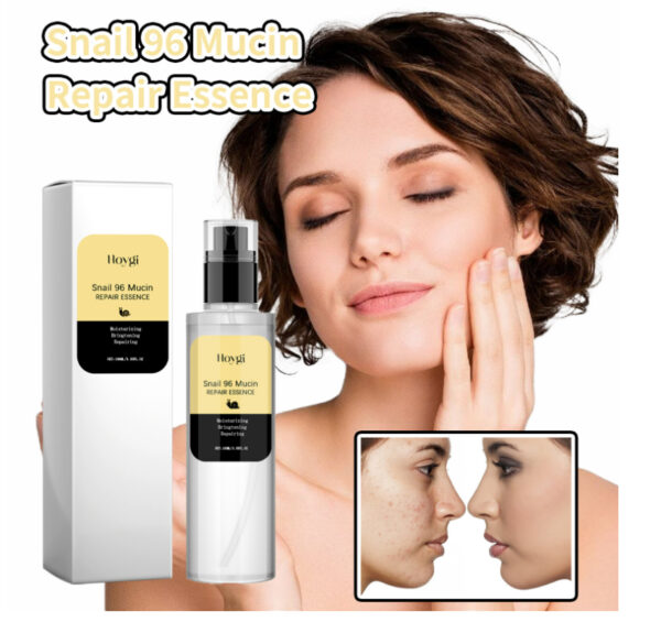 Hydrating Snail Essence 96 – Deep Repair & Glow Boost - Image 2