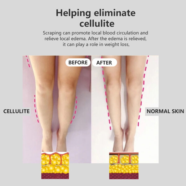 Fashion Intelligent Electric Gua Sha Instrument - Image 3