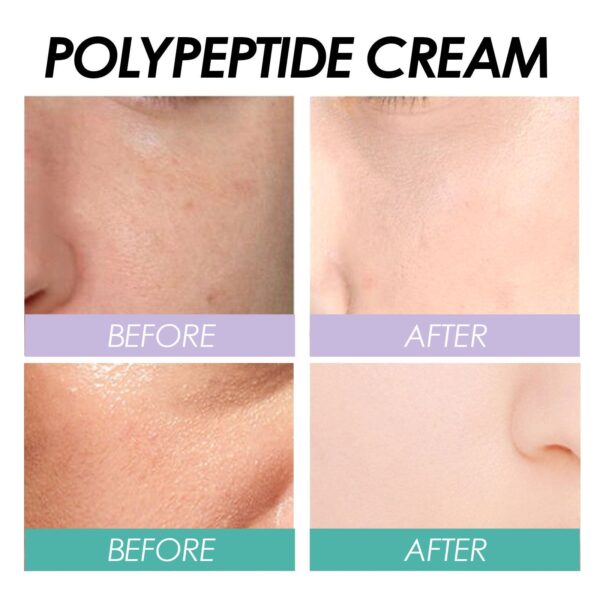 Radiance Boost Facial Cream – Deep Moisturizing & Gentle Brightening - Image 8