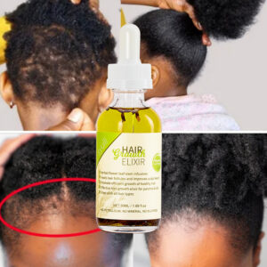 Rosemary Herbal Hair Growth & Repair Oil — Stimulates Roots & Restores Shine