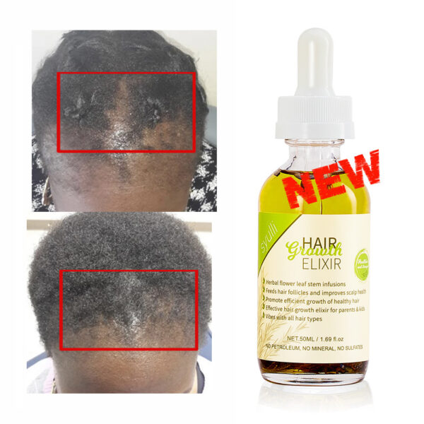 Rosemary Herbal Hair Growth & Repair Oil — Stimulates Roots & Restores Shine - Image 3